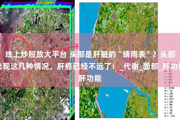 线上炒股放大平台 头部是肝脏的“晴雨表”？头部出现这几种情况，肝癌已经不远了！_代谢_面部_肝功能